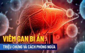 Bệnh viêm gan bí ẩn là gì? Triệu chứng cần chú ý để bảo vệ sức khỏe