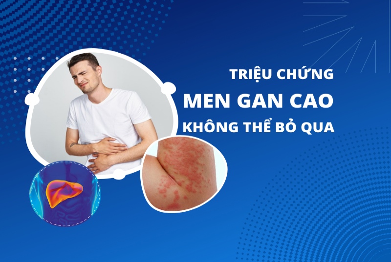 Men gan cao là bệnh gì? Dấu hiệu cần đi khám ngay