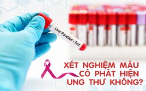 Xét nghiệm máu có phát hiện ung thư không?