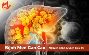 Bệnh men gan cao có những triệu chứng gì?