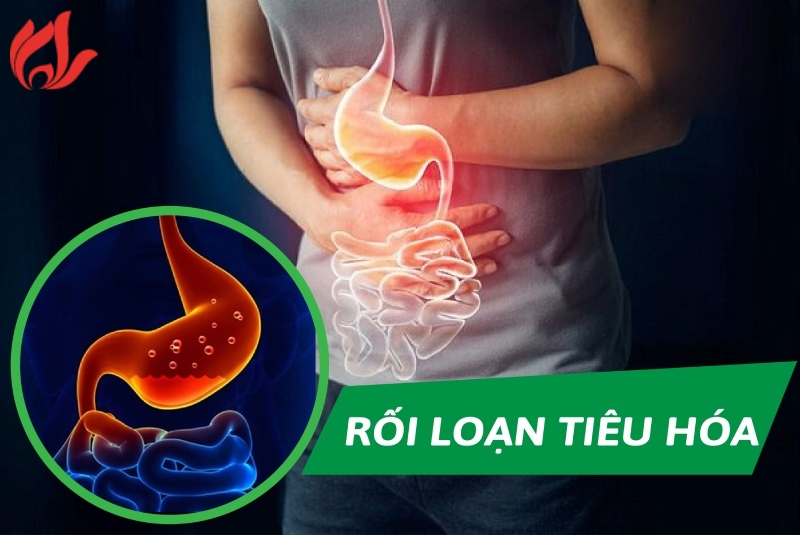 Bị rối loạn tiêu hoá nên làm gì để nhanh khỏi?