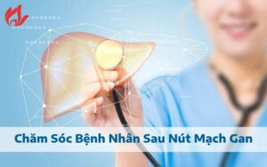 Chăm sóc bệnh nhân sau nút mạch gan tại nhà