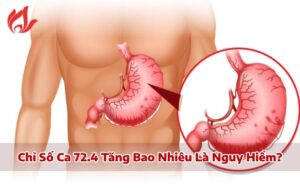 Chỉ số CA 72.4 tăng bao nhiêu nguy hiểm? Khi nào cần xét nghiệm CA 72.4?