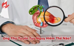 Triệu chứng nhận biết ung thư tuyến tụy sớm