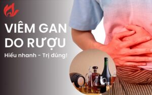 Viêm gan do rượu có gây nguy hiểm không?