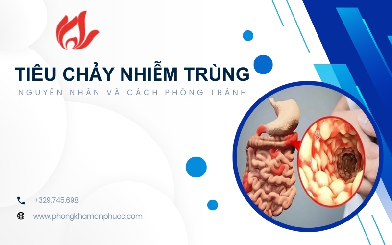 Tiêu chảy nhiễm trùng là gì? Nguyên nhân và cách phòng tránh