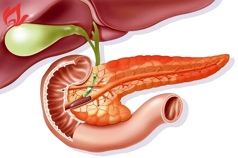 Viêm tụy cấp là gì?