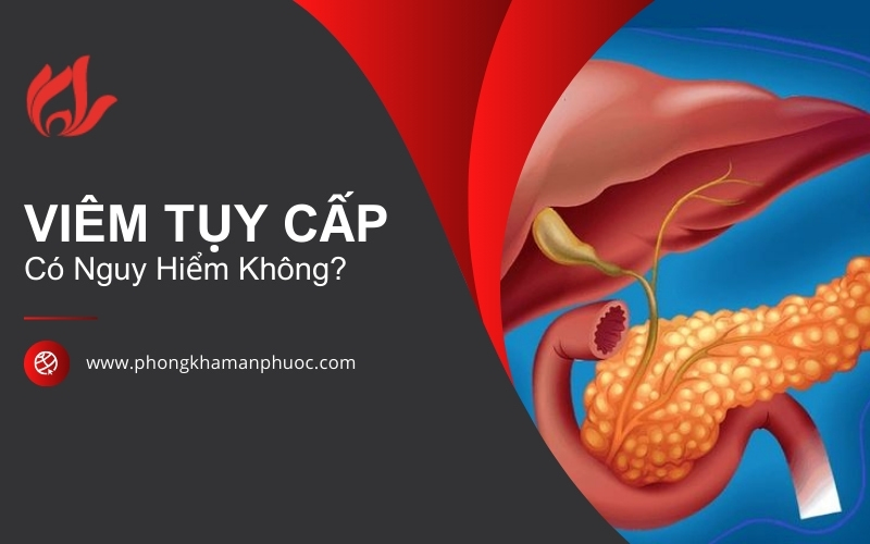 Viêm tụy cấp có nguy hiểm không? Những biến chứng cần lưu ý