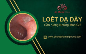 Người bị loét dạ dày cần kiêng gì để không tái phát?