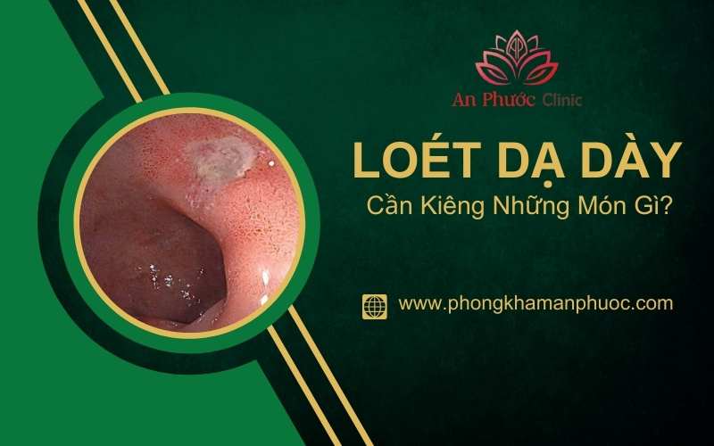 Người bị loét dạ dày cần kiêng gì để không tái phát?