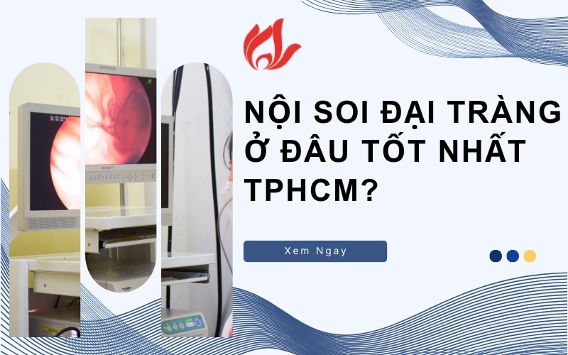 Nội soi đại tràng ở đâu tốt nhất TPHCM? 5 địa chỉ uy tín
