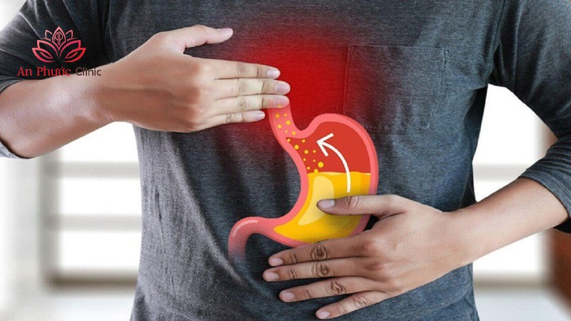 Trào ngược dạ dày là gì?
