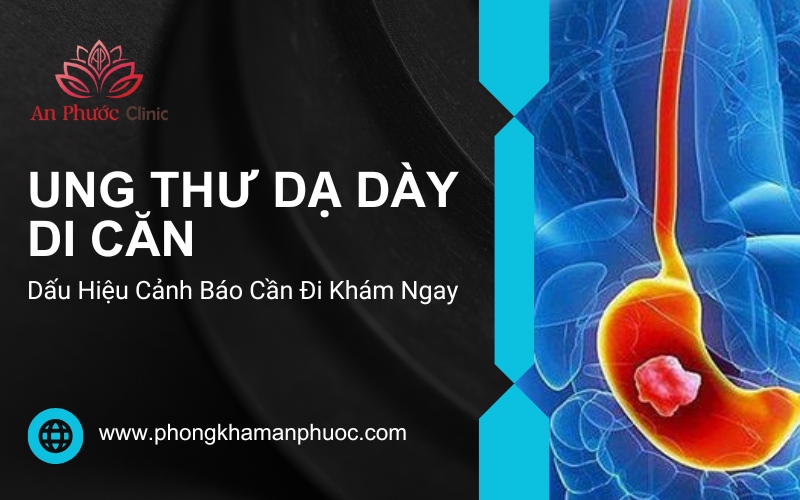 Dấu hiệu cảnh báo ung thư dạ dày di căn cần đi khám ngay