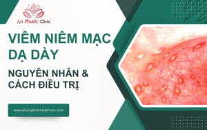 Viêm niêm mạc dạ dày là gì? Nguyên nhân và cách điều trị