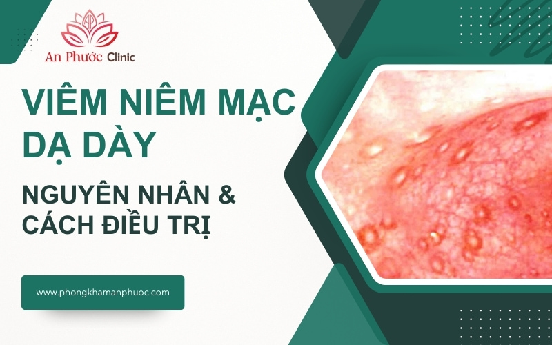 Viêm niêm mạc dạ dày là gì? Nguyên nhân và cách điều trị