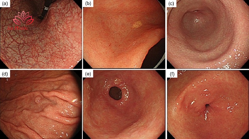 Chẩn đoán và điều trị