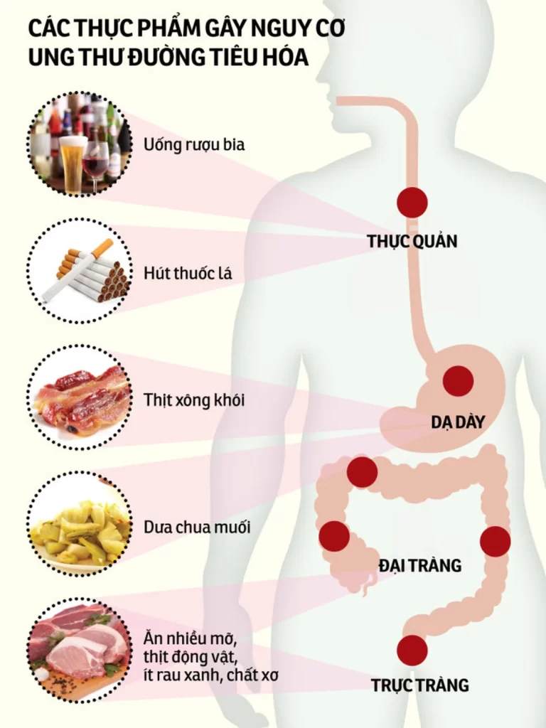 Thực phẩm gây nguy cơ ung thư đường tiêu hoá

