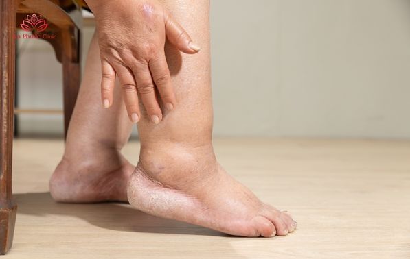 Triệu chứng của báng bụng