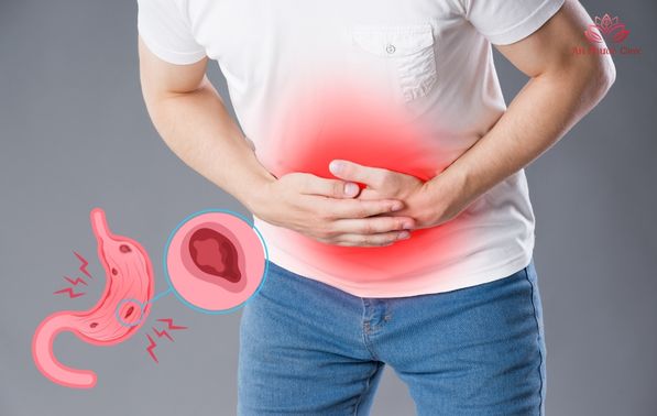 Triệu chứng của viêm loét dạ dày tá tràng