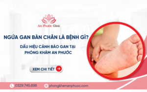 ngứa gan bàn chân là bệnh gì
