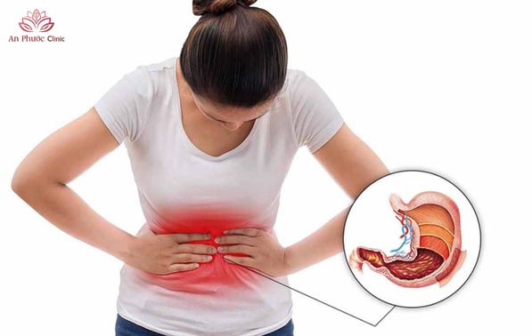 Xung huyết dạ dày là gì?