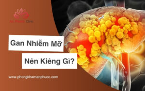 Người mắc bệnh gan nhiễm mỡ kiêng ăn gì?