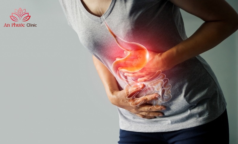 Co thắt dạ dày là gì?