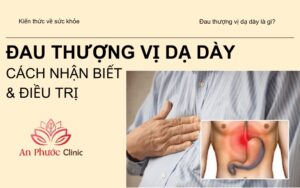Phương pháp hiệu quả để điều trị chứng đau thượng vị dạ dày