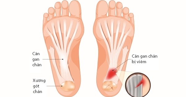 Dấu Hiệu Ngứa Gan Bàn Chân Cảnh Báo Bệnh Gan