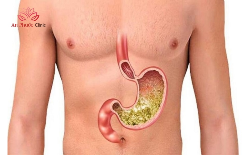 Vị trí dạ dày nằm ở đâu trong cơ thể?