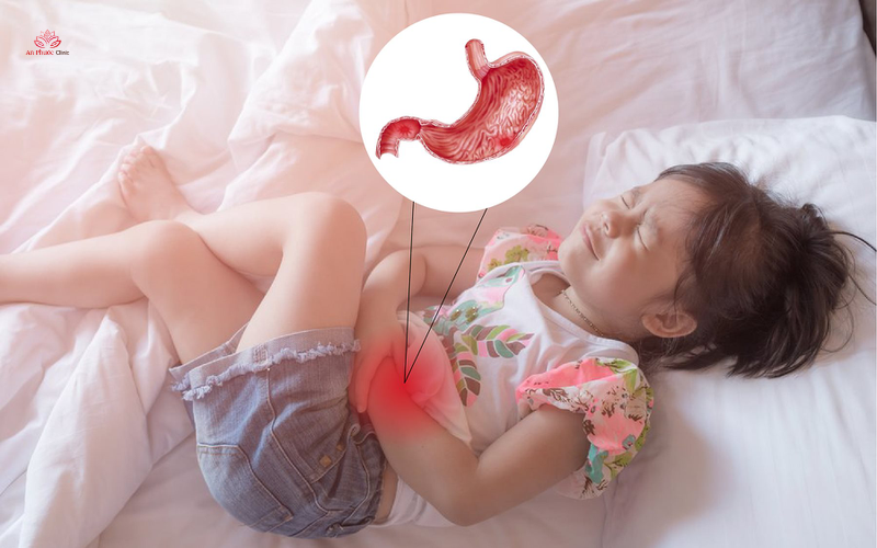 Cách xử lý chảy máu dạ dày