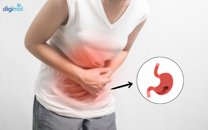 Chảy máu dạ dày là gì?
