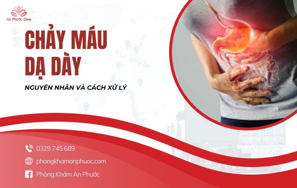 Nguyên nhân chính gây chảy máu dạ dày và cách xử lý