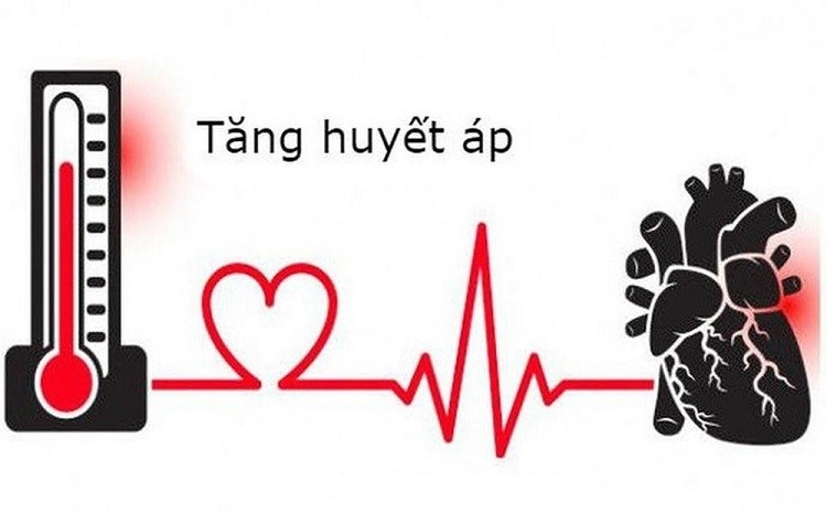 tăng huyết áp