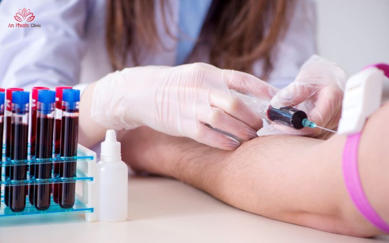 Cách chẩn đoán bệnh lao ruột