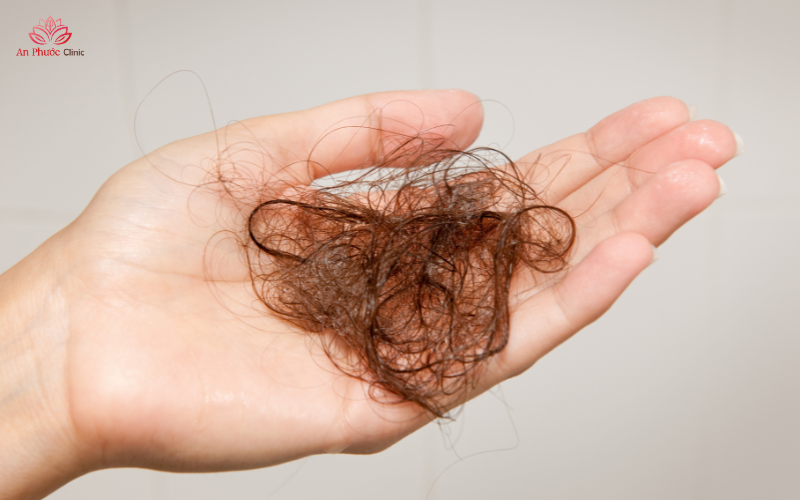 Biểu hiện khá phổ biến khi mẹ bị rối loạn nội tiết tố sau sinh