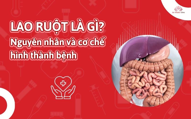 Lao ruột là gì? Nguyên nhân và cơ chế hình thành bệnh