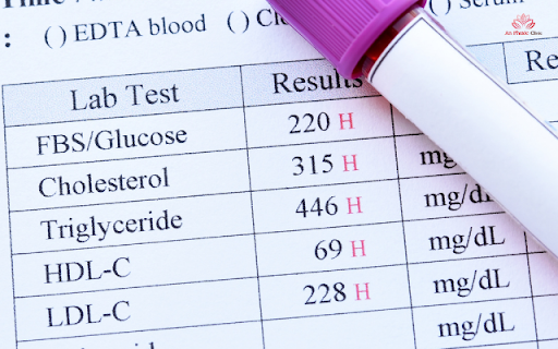 Cách đo đường huyết hiệu chính xác tại nhà