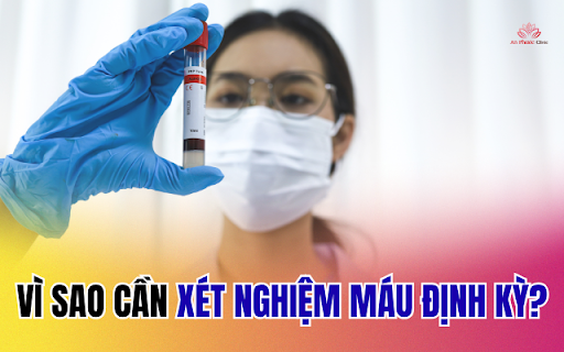 Vì sao cần xét nghiệm máu định kỳ?