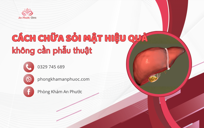 Cách chữa sỏi mật hiệu quả không cần phẫu thuật