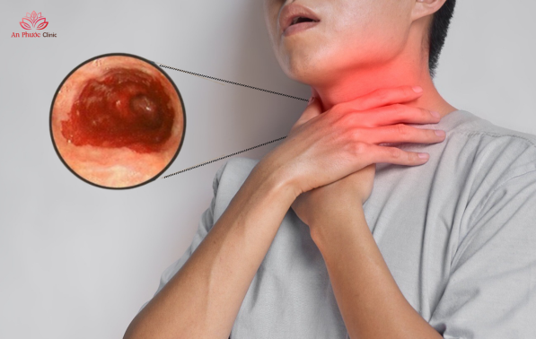 Biến chứng nguy hiểm nếu không điều trị