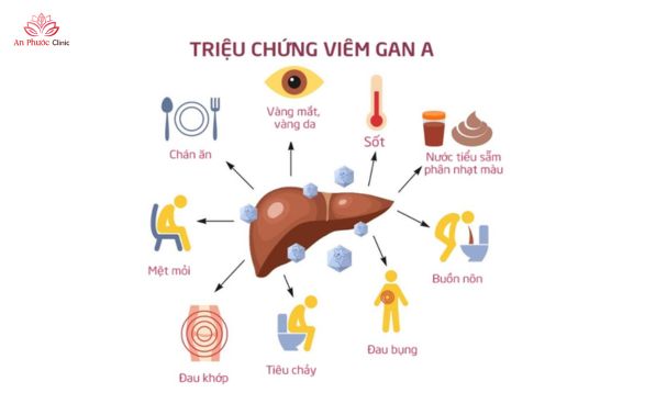 Dấu hiệu nhận biết viêm gan A