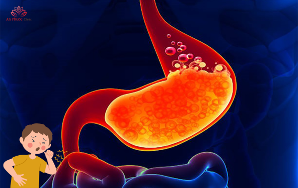 Nguyên nhân dẫn đến ho do trào ngược dạ dày