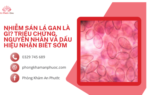 Nhiễm sán lá gan là gì? Triệu chứng và dấu hiệu nhận biết