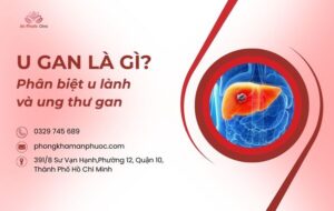 U gan là gì Phân biệt u lành và ung thư gan