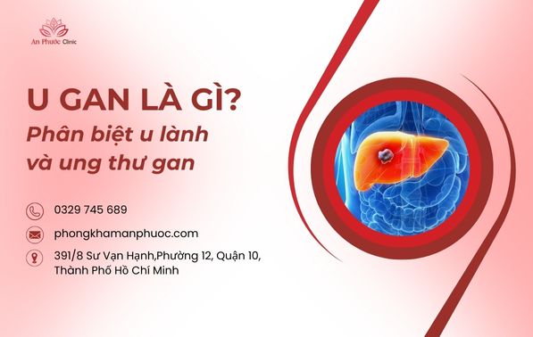 U gan là gì Phân biệt u lành và ung thư gan