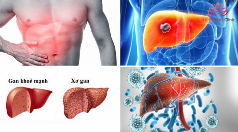 Một số biến chứng thường gặp