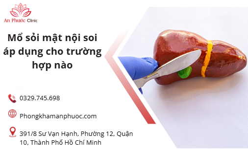 Mổ sỏi mật nội soi áp dụng cho trường hợp nào