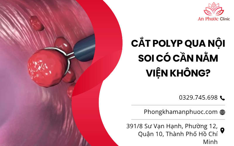 Cắt polyp qua nội soi có cần nằm viện không