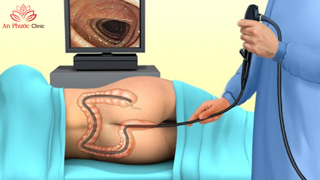 Gây mê nội soi là gì?